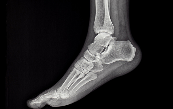 Healthy-ankle-NF-podiatry Healthy-ankle-NF-podiatry
