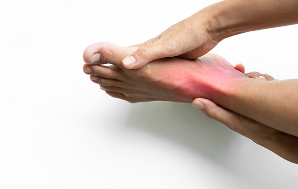 Sprained-Ankle-redness-NF-Podiatry Sprained-Ankle-redness-NF-Podiatry