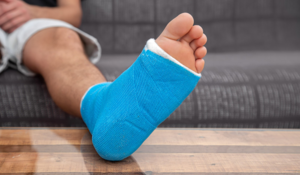 Blue-cast-on-table-NF-Podiatry