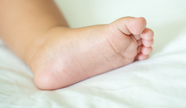 Baby-flat-feet-NF-Podiatry Baby-flat-feet-NF-Podiatry