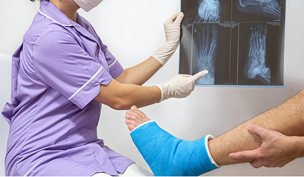 Patient-with-fractured-feet-NF-Podiatry Patient-with-fractured-feet-NF-Podiatry